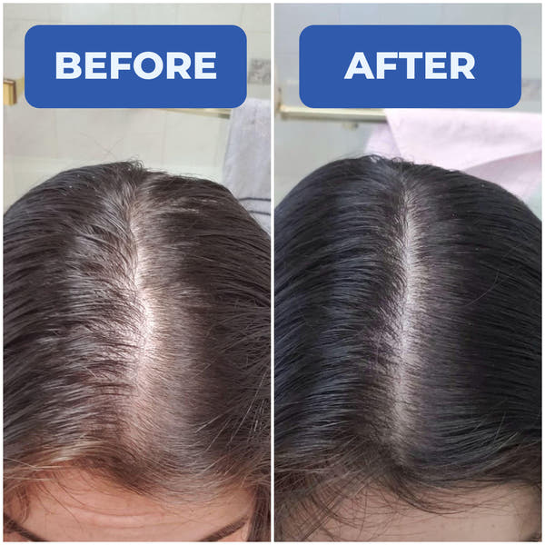 HairFull™ Hair Growth Roll-on Serum