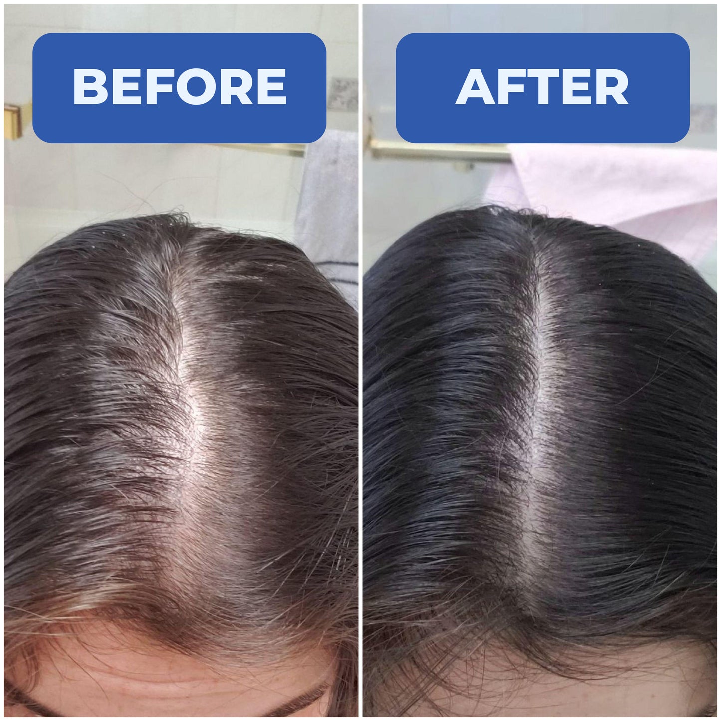 HairFull™ Hair Growth Roll-on Serum